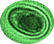 Brettanomyces